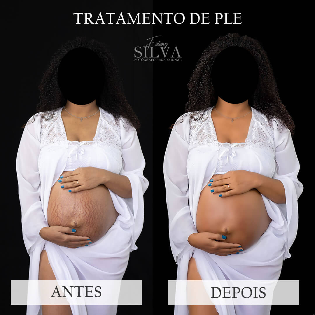 fotografo-gestantes-londriana-cambe-ibipora-2